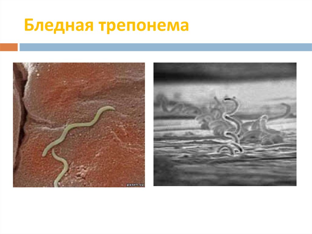 Заболевания вызываемые трепонемой. Сифилис бледная трепонема. Бледная трепонема это бактерия. Бледная трепонема под микроскопом.