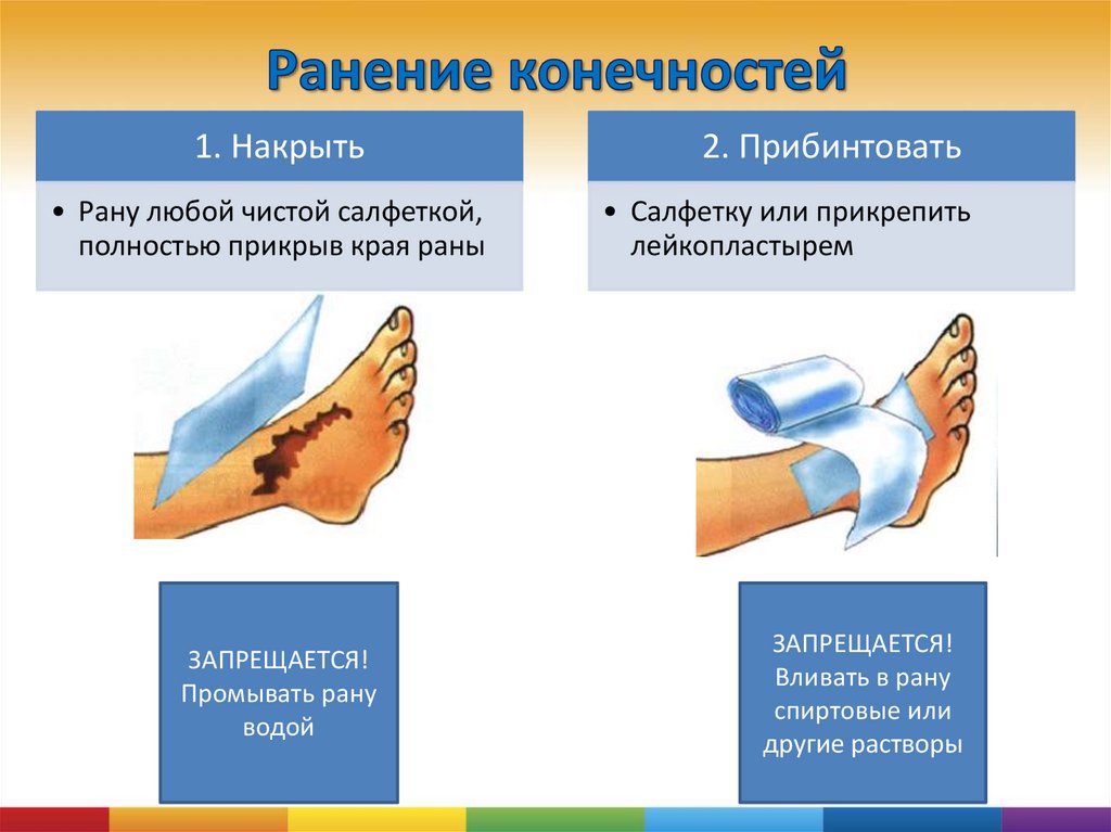 При травме конечностей необходимо