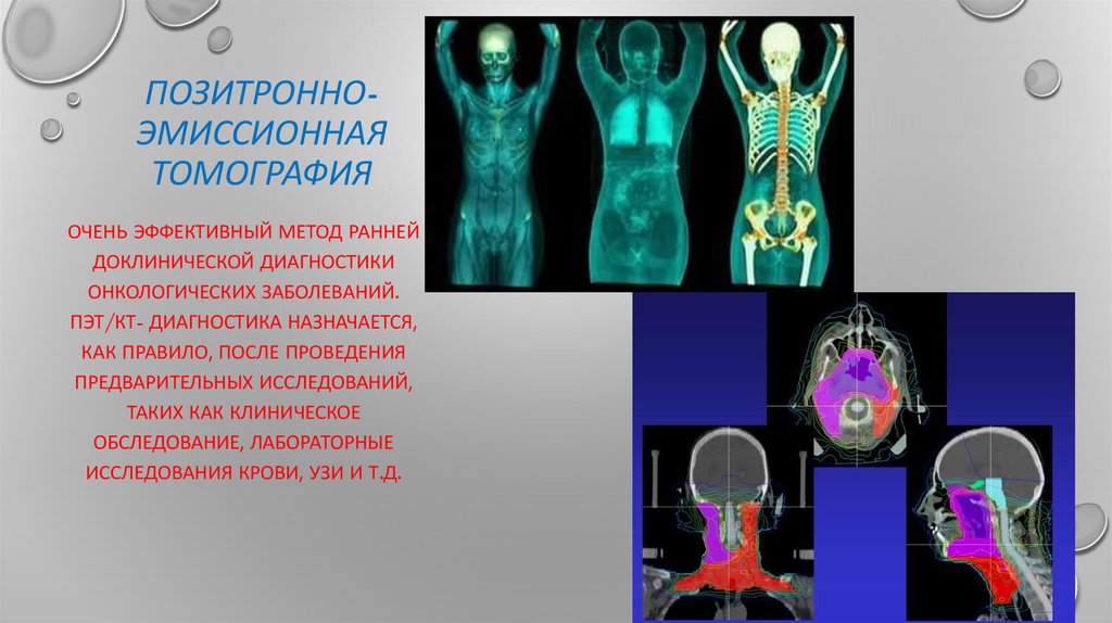 Пэт кт презентация