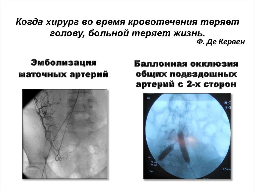 Перинатология негіздері презентация