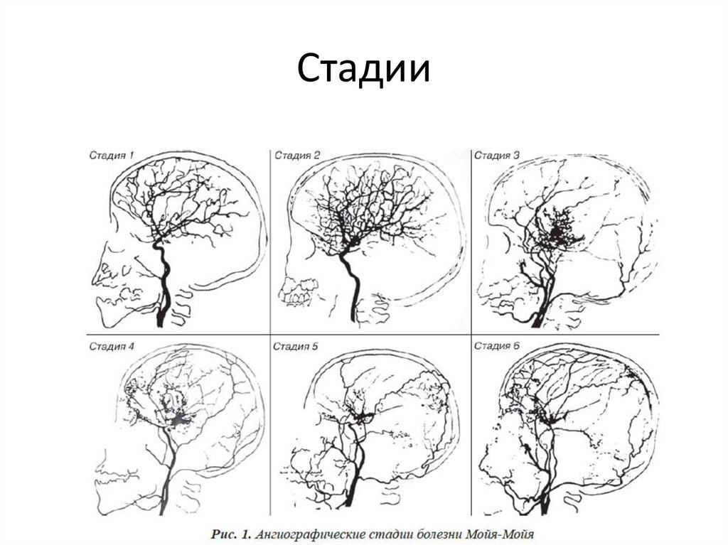 Болезнь моя моя