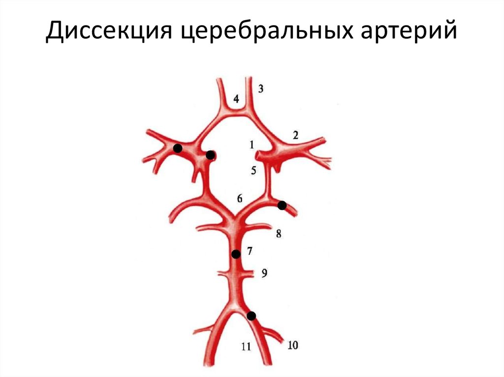 Аневризма шейного отдела