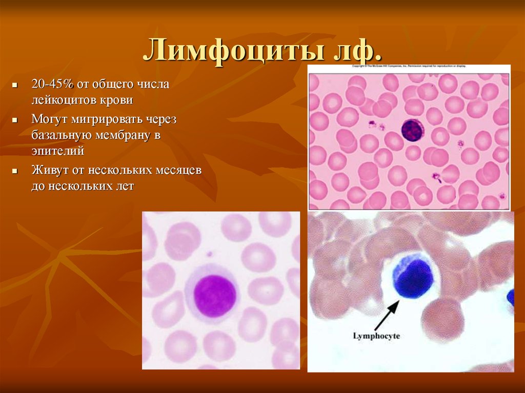 Реактивные лимфоциты в крови. Лимфоциты. Лимфоциты в крови. Незрелые лимфоциты. Незрелые лимфоциты в крови.