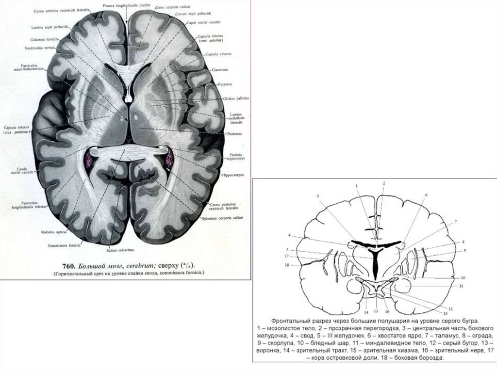 Прозрачная перегородка мозга. Фронтальный срез головного мозга Зрительная кора. Хвостатое ядро мозга кт. Базальные ядра внутренняя капсула. Схема аксиальных срезов головного мозга.