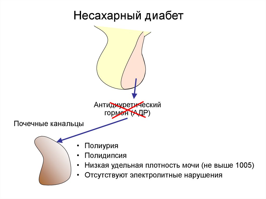 Несахарный диабет презентация эндокринология