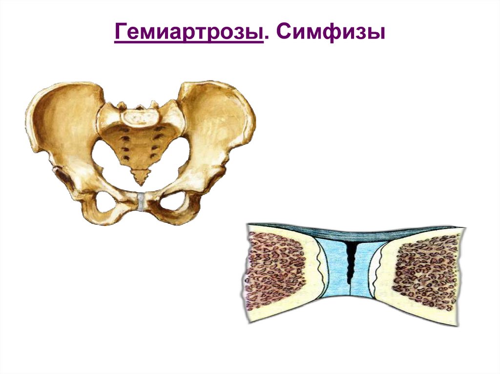 Симфизит это. Полусуставы симфизы. Гемиартрозы симфизы. Соединение костей таза лобковый симфиз. Гемиартрозы соединение костей.