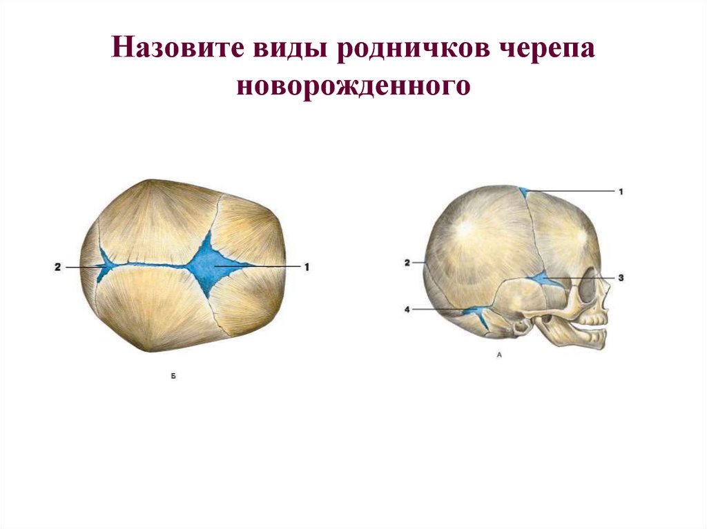 Роднички плода. Роднички черепа новорожденного образованы. Роднички новорожденного анатомия черепа. Соединение костей черепа роднички. Кости черепа швы и роднички.
