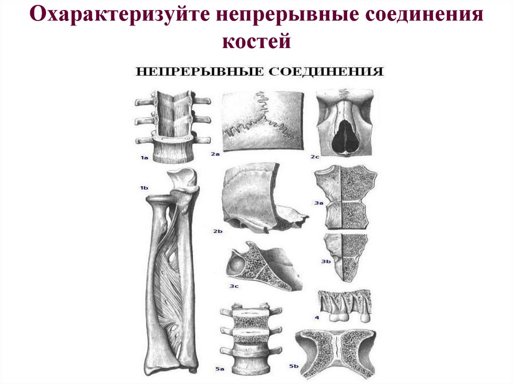 Непрерывные кости. Соединение костей непрерывные прерывные полусуставы. Непрерывное соединение синдесмоз. Соединения костей непрерывные соединения синдесмозы. Синхондроз синостоз.