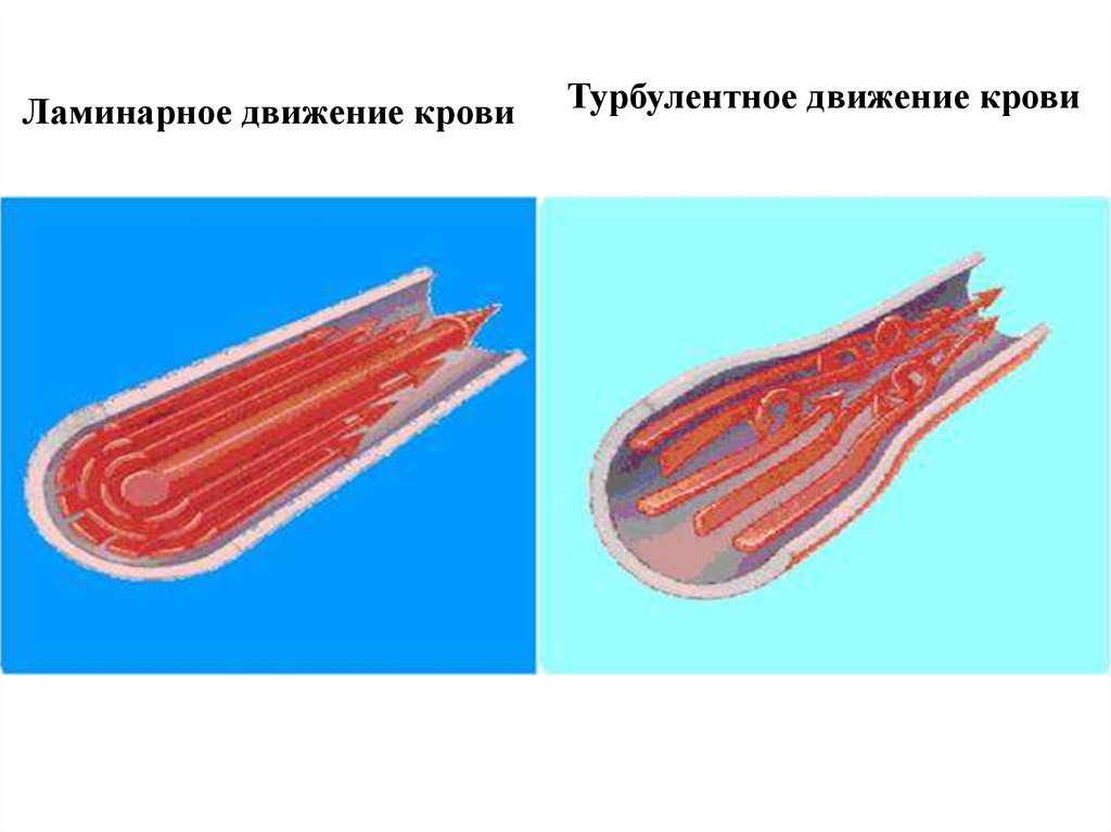 Ламинарный поток. Ламинарный и турбулентный ток крови. Ламинарное и турбулентное движение. Ламинарный поток крови. Ламинарный и турбулентный поток жидкости.