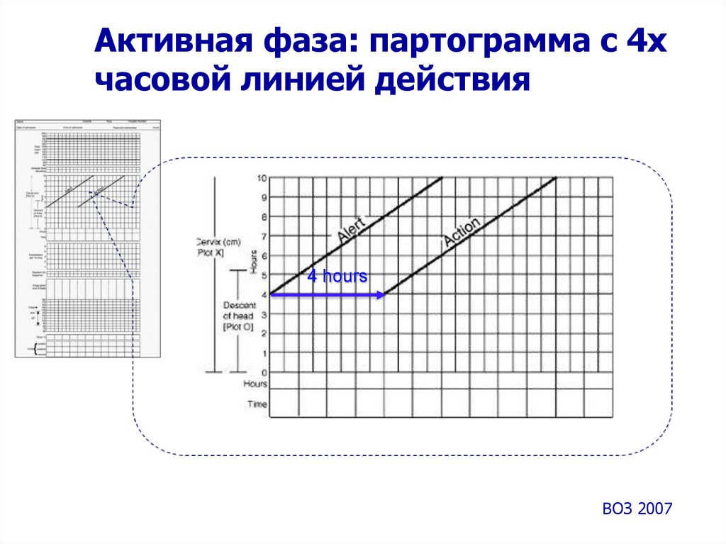 Партограмма в акушерстве как заполнять образец заполнения