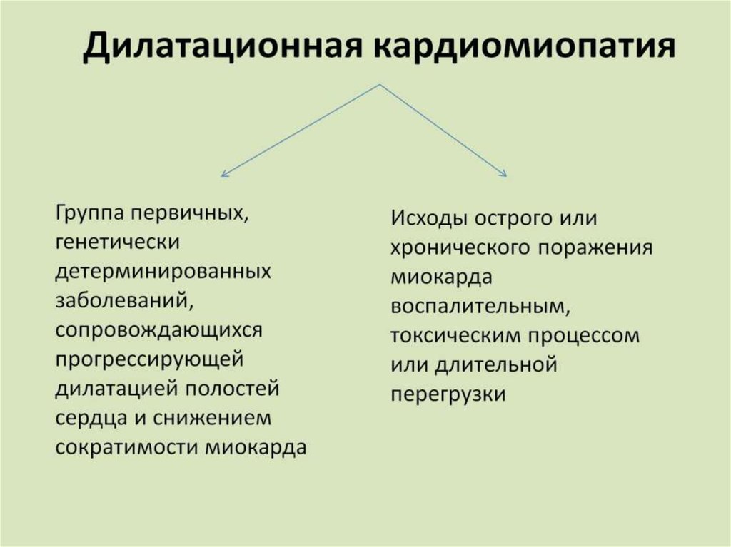 Дилатационная кардиомиопатия