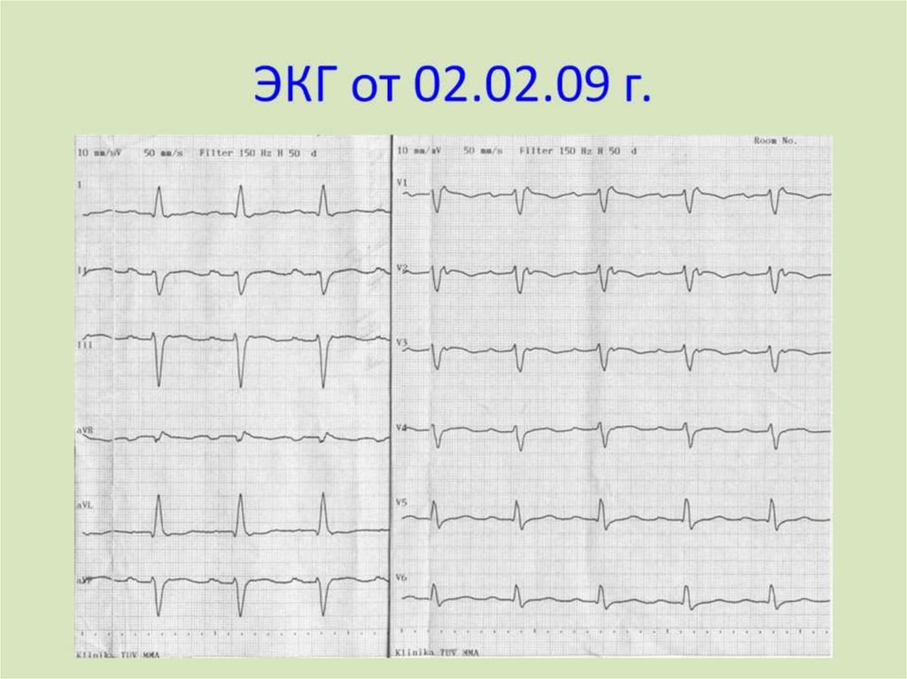 ЭКГ от 02.02.09 г.