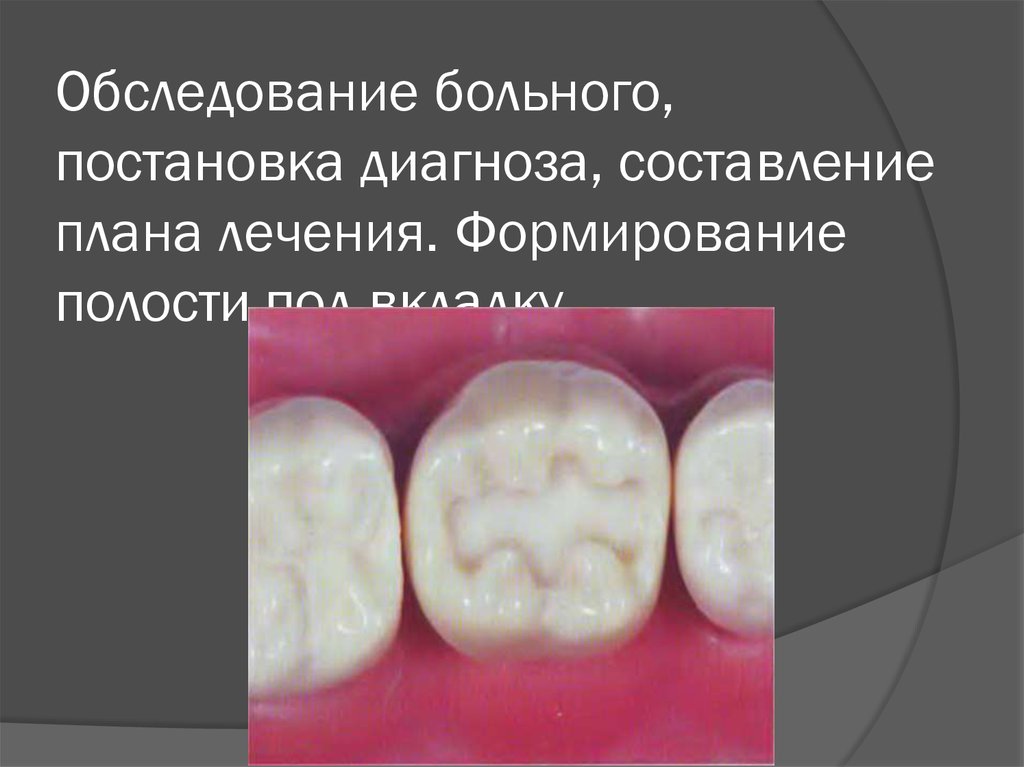 Вкладки ортопедическая стоматология презентация