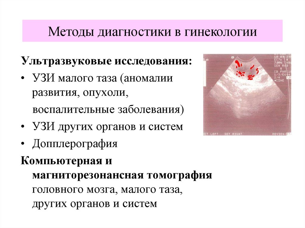 Методы обследования в акушерстве презентация