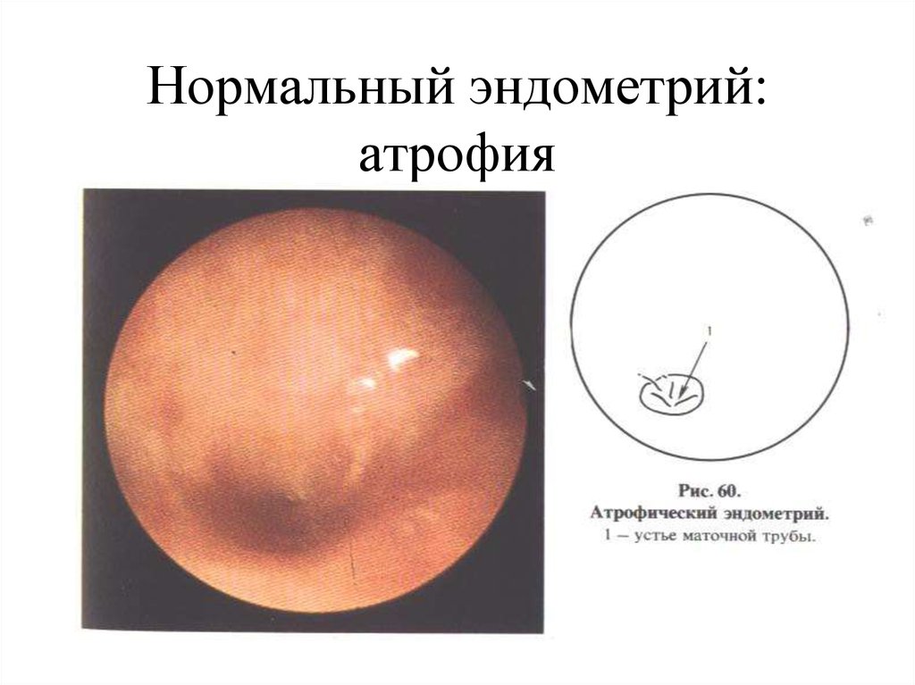 Проба шиллера это