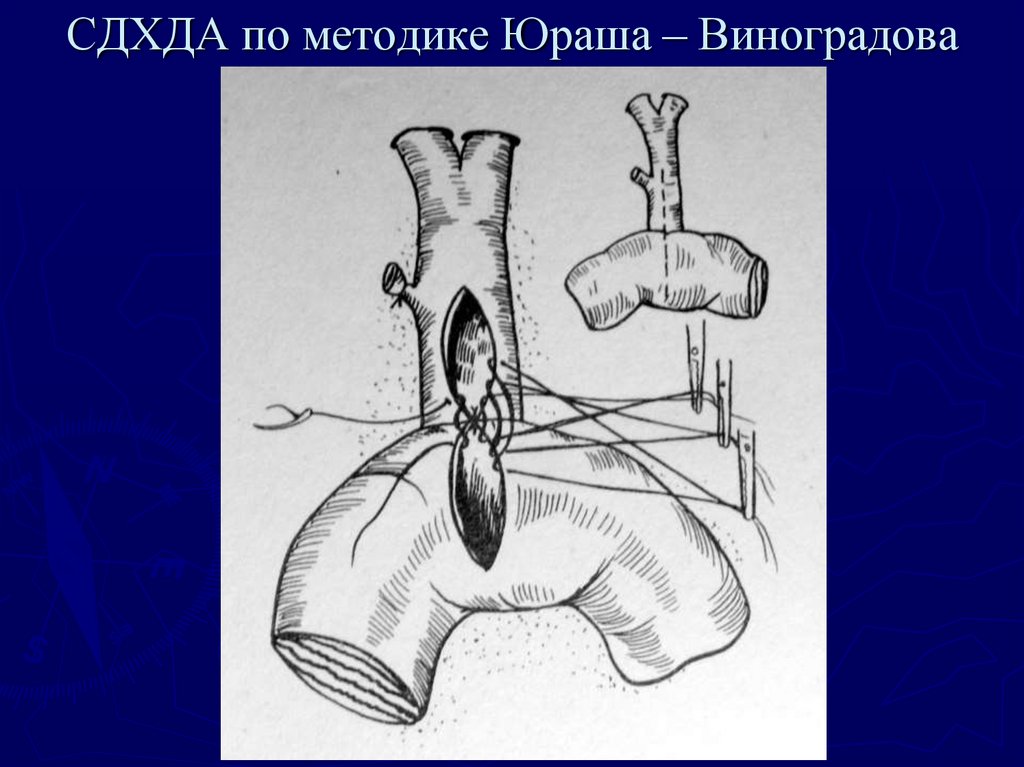 Хирургия механическая желтуха презентация