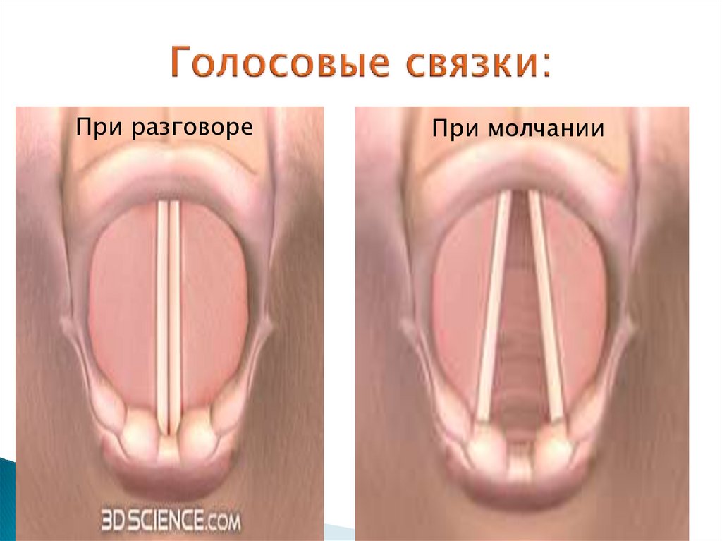 Подрезка голосовых связок