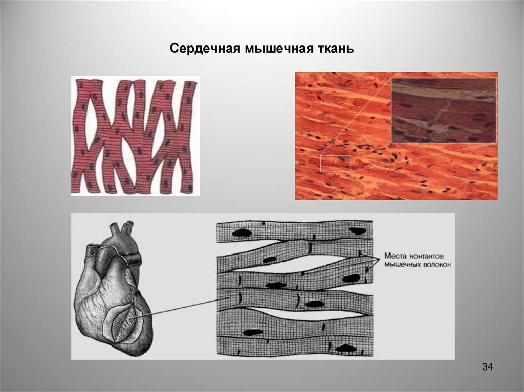 Сердечная мышечная ткань рисунок