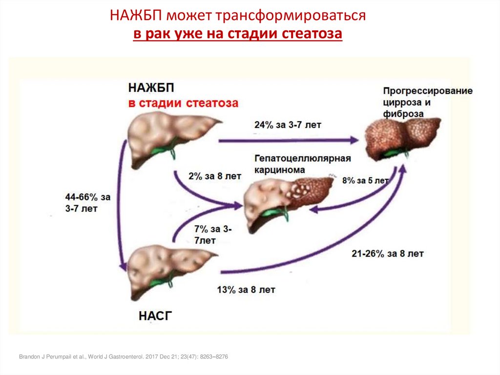 Неалкогольная болезнь