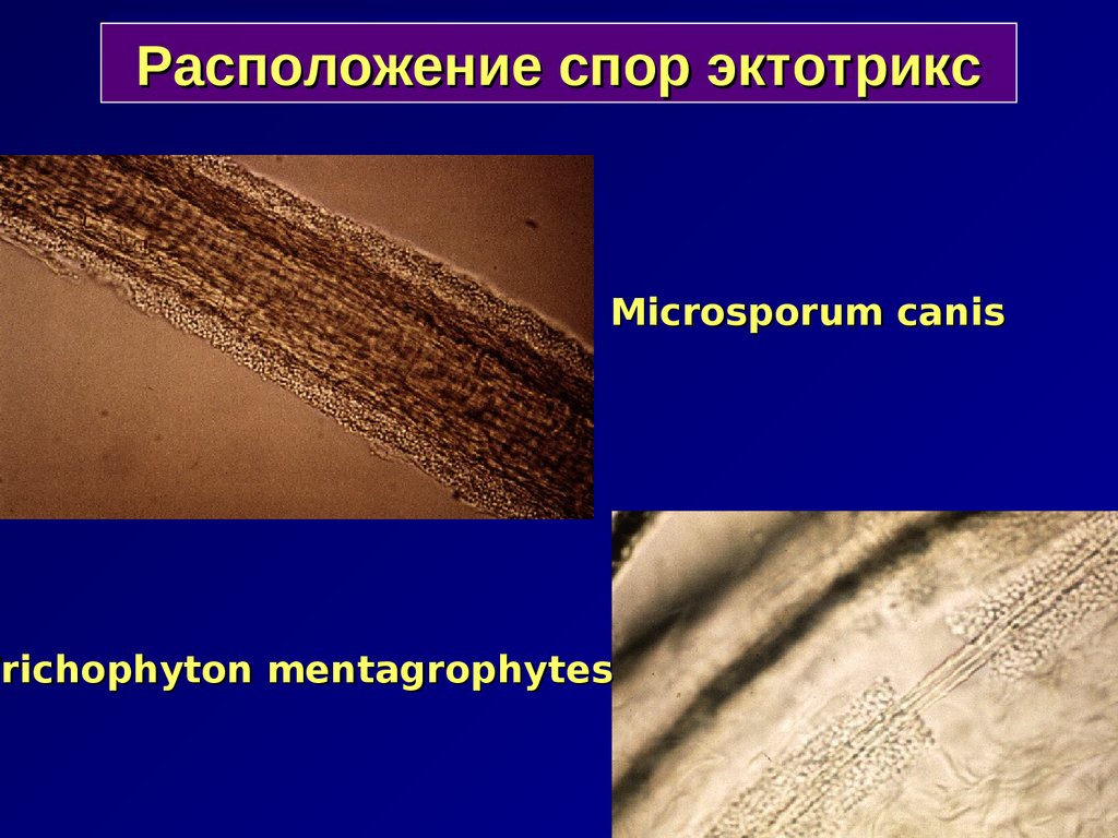 Тип поражения волос endothrix картинка