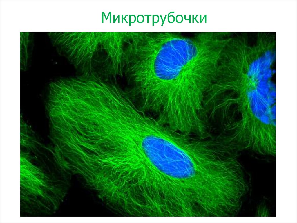 Микротрубочки. Микротрубочки в микроскопе. Клеточный тубулин. Цитоскелет клетки микротрубочки тубулин. Цитоскелет клетки Веретено деления.