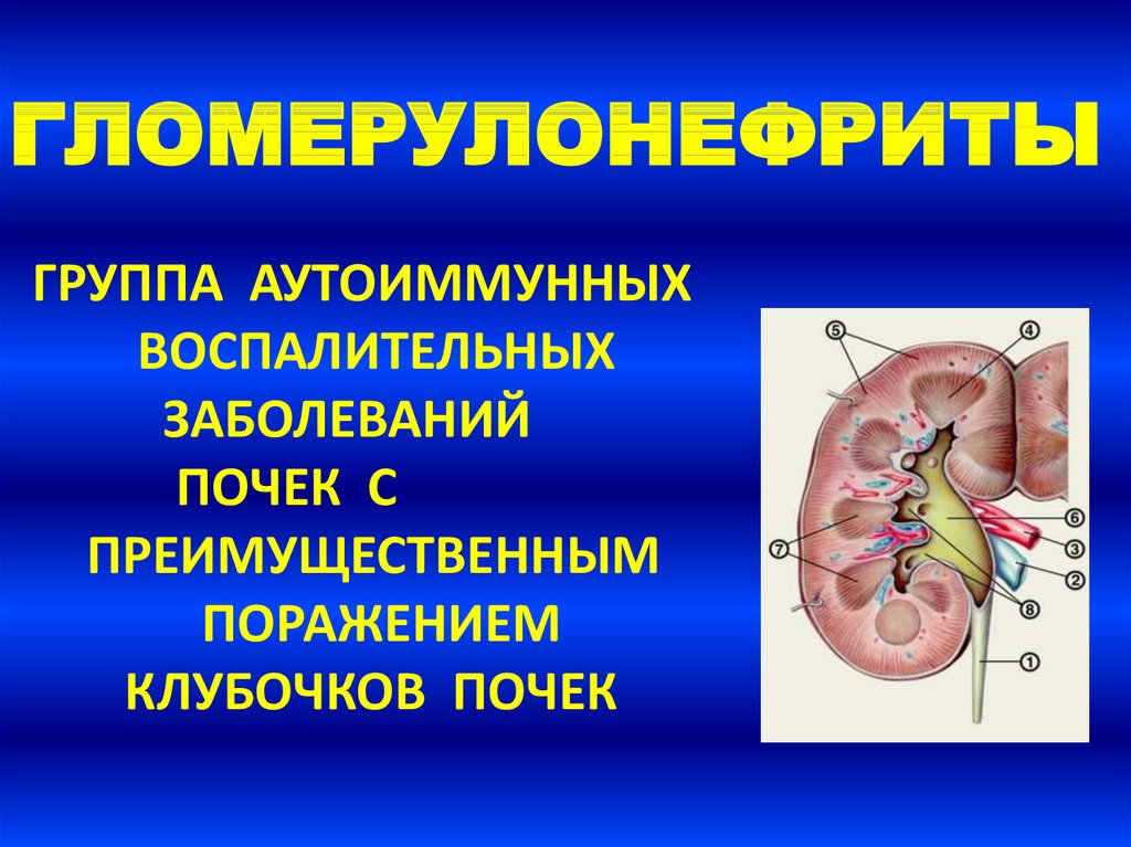 Гломерулонефрит у детей презентация