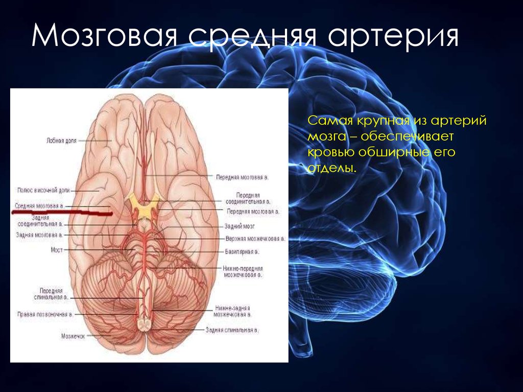 Инсульт левой средней мозговой артерии