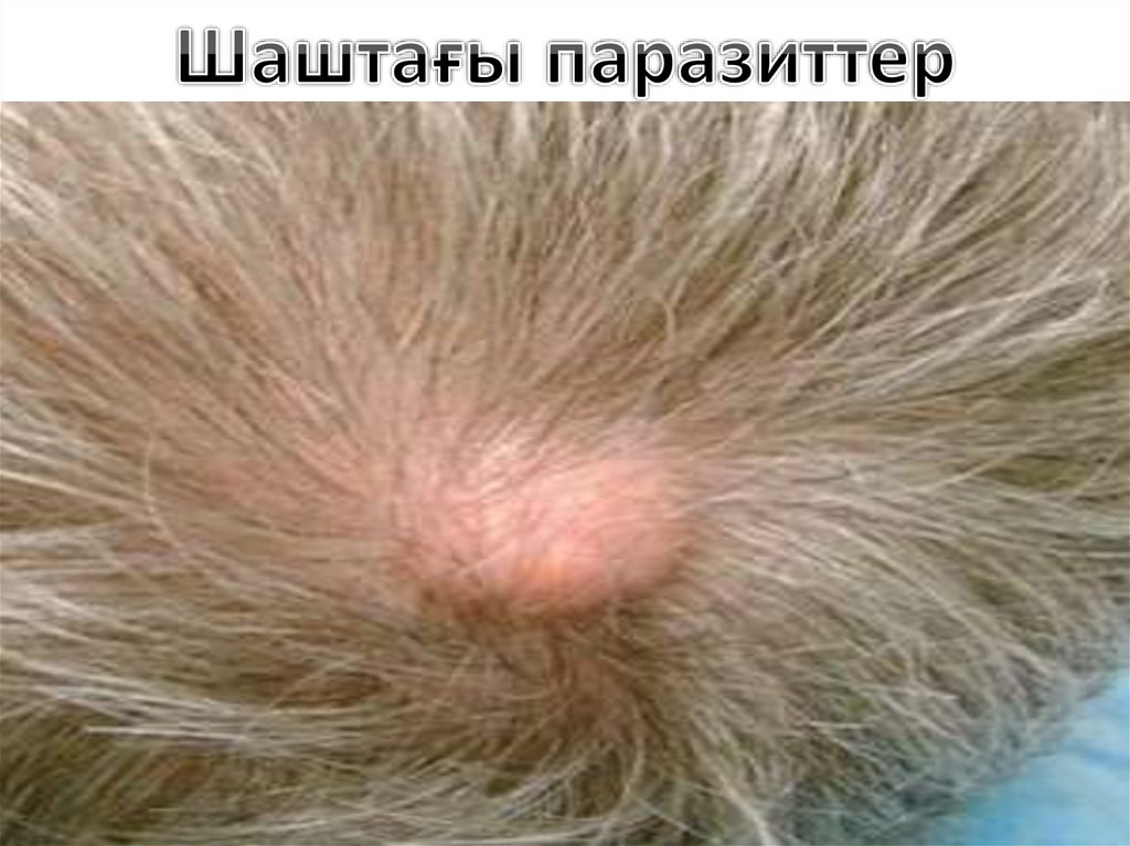 Паразиттер - презентация онлайн
