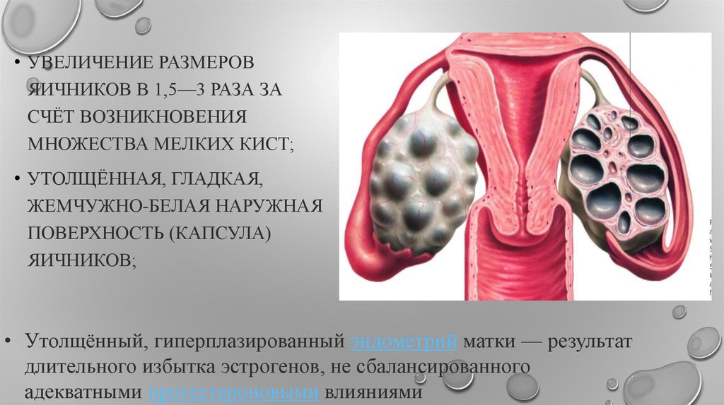 Диаметр яичника. Увеличение размеров яичников. Увеличенный размер яичников.
