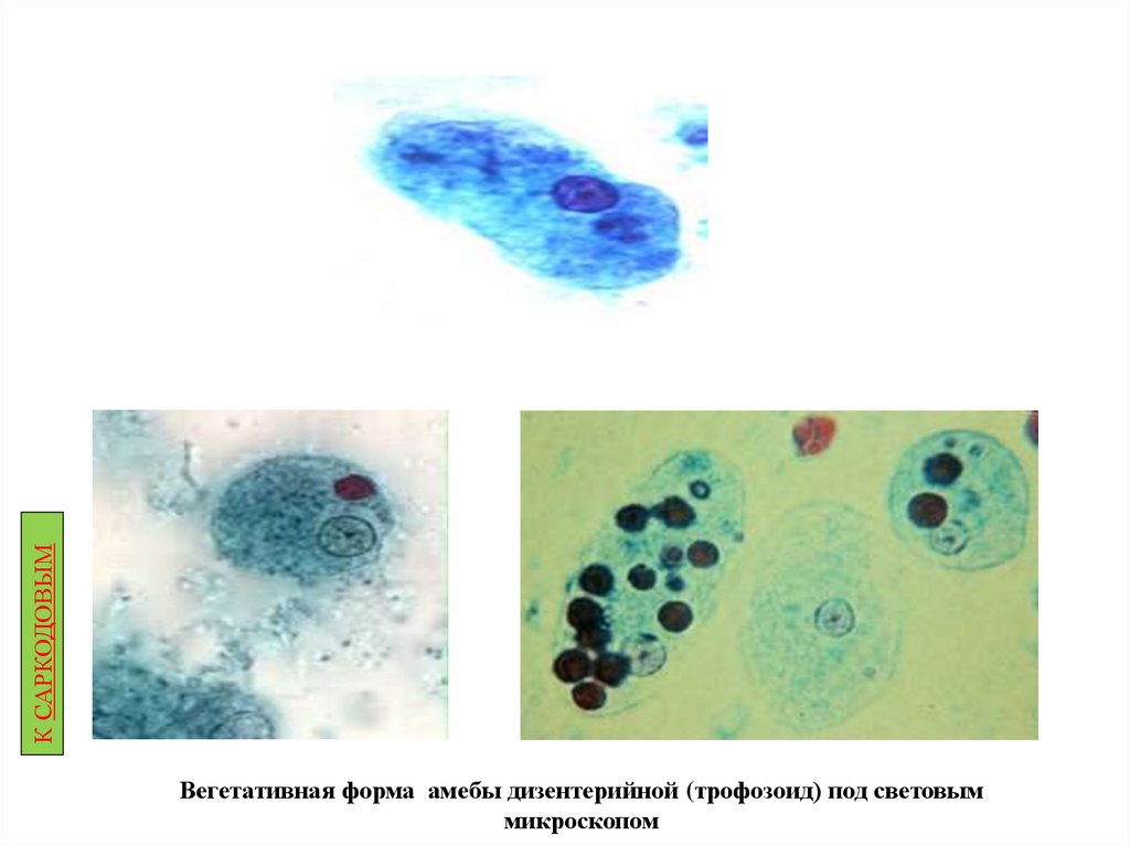 Форма амебы. Вегетативная форма дизентерийной амебы. Форма Магна дизентерийной амебы. Дизентерийная амеба препарат. Большая вегетативная форма дизентерийной амёбы.