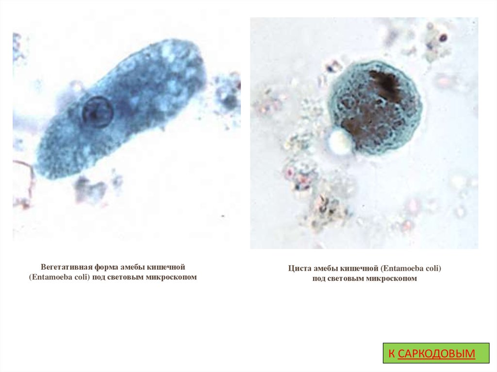 Кишечная амеба рисунок