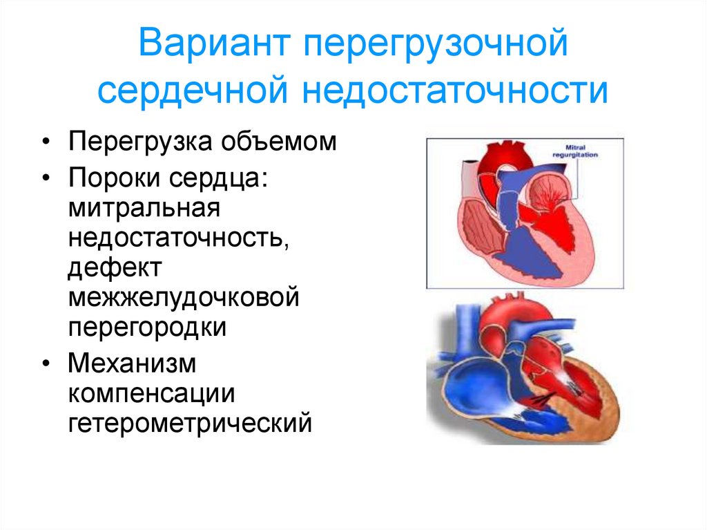 Длительная сердечная недостаточность. Этиология перегрузочной формы сердечной недостаточности. Перегрузочная форма сердечной недостаточности причины. Патогенез перегрузочной формы сердечной недостаточности. Перегрузочная сердечная недостаточность.
