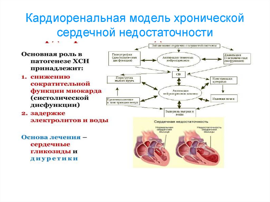 Механизм развития сердечной недостаточности. Механизм развития синдрома хронической сердечной недостаточности. Патогенез сердечной недостаточности модель. Синдром хронической сердечной недостаточности патогенез. Механизм развития кардиоренального синдрома.