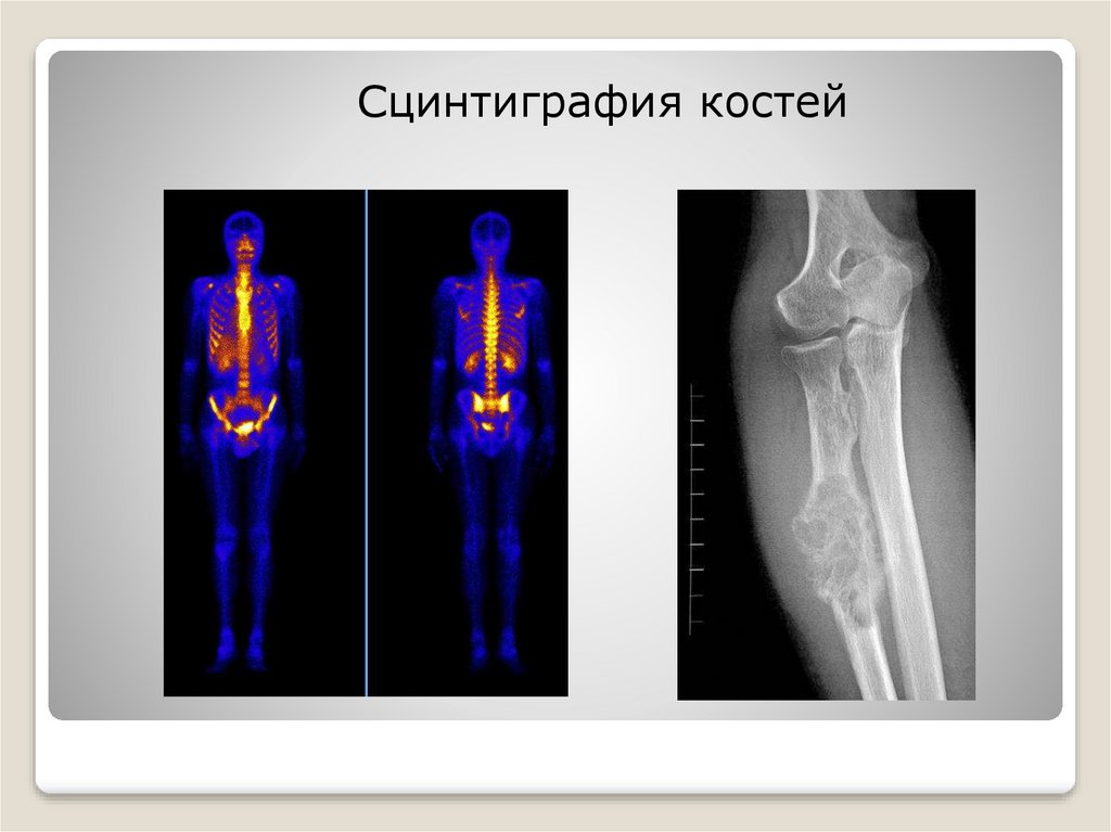 Подготовьте компьютерную презентацию по теме использование радиоактивных изотопов в медицине