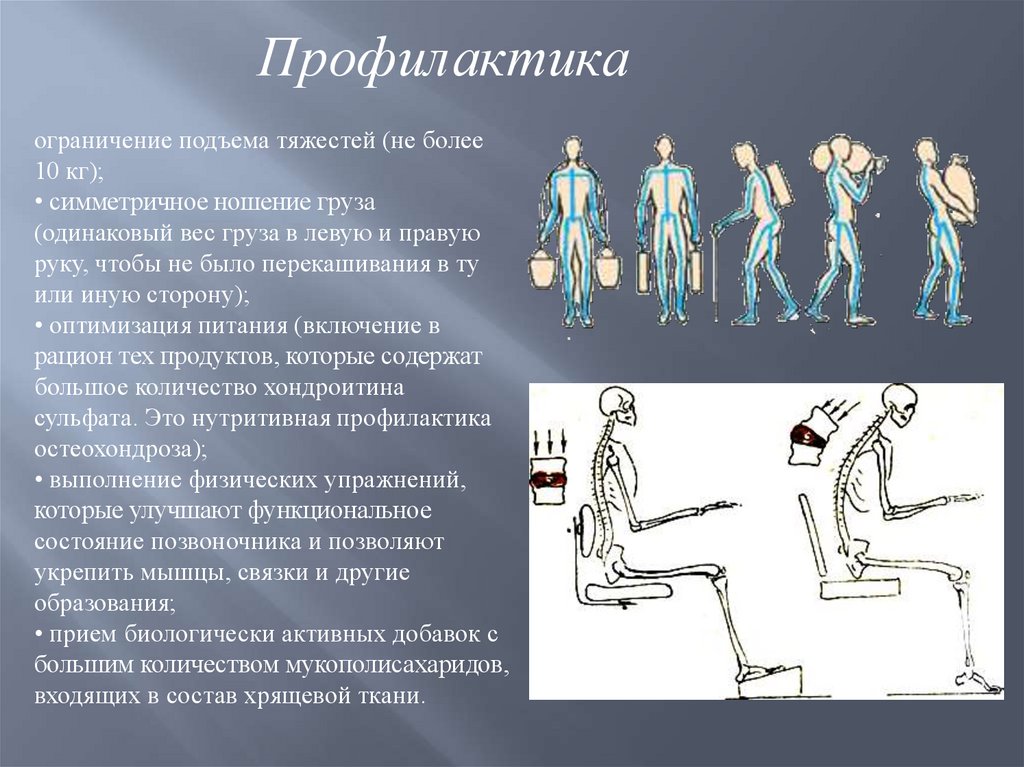 Подъем тяжести приводит. Профилактика остеохондроза. Профилактика остеохондроза при поднятии тяжести. Заболевания связанные с поднятием тяжести. Подъем тяжестей.