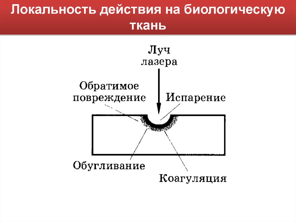 На рисунке представлены эффекты высокоинтенсивного лазерного излучения на биологические ткани где