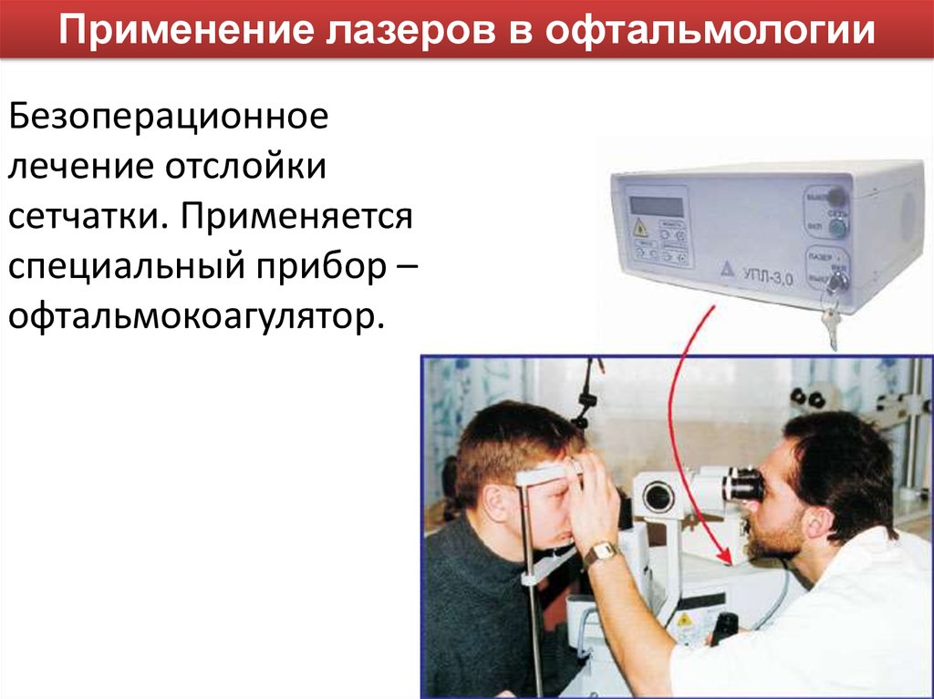 Лазеры в офтальмологии презентация