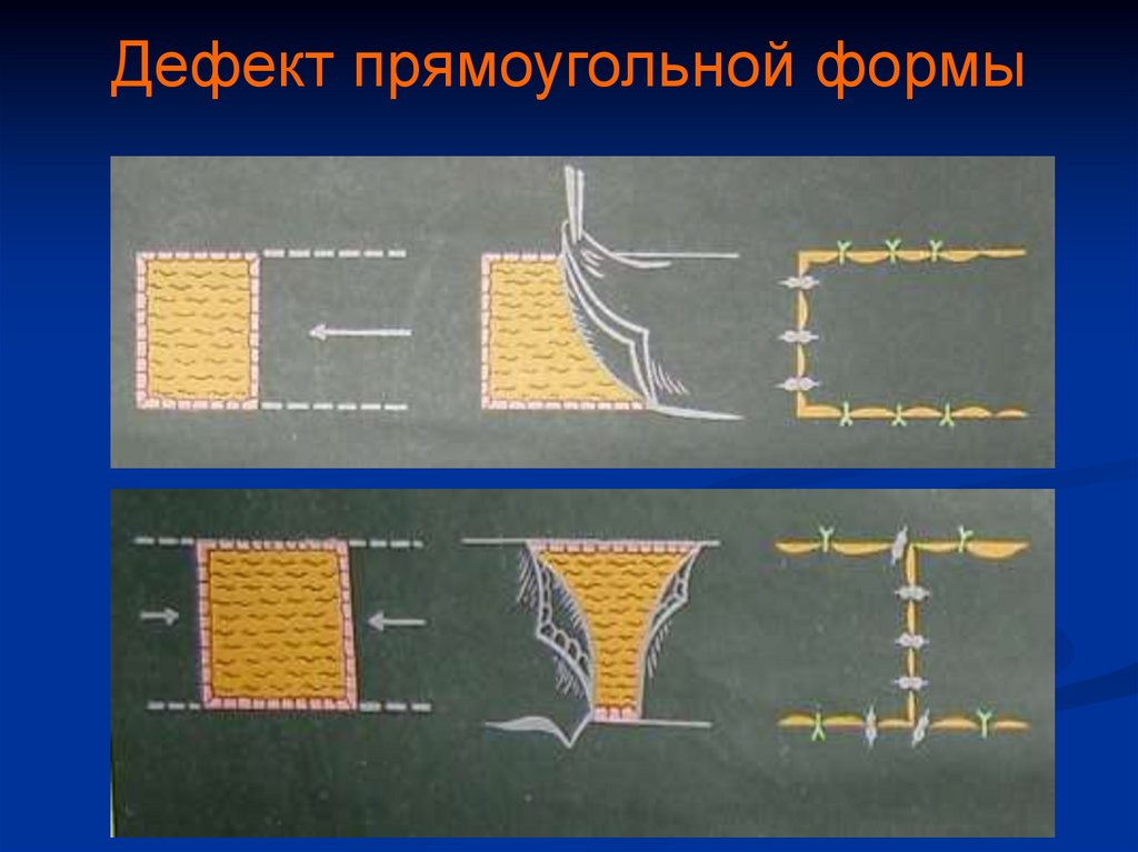 Местные ткани