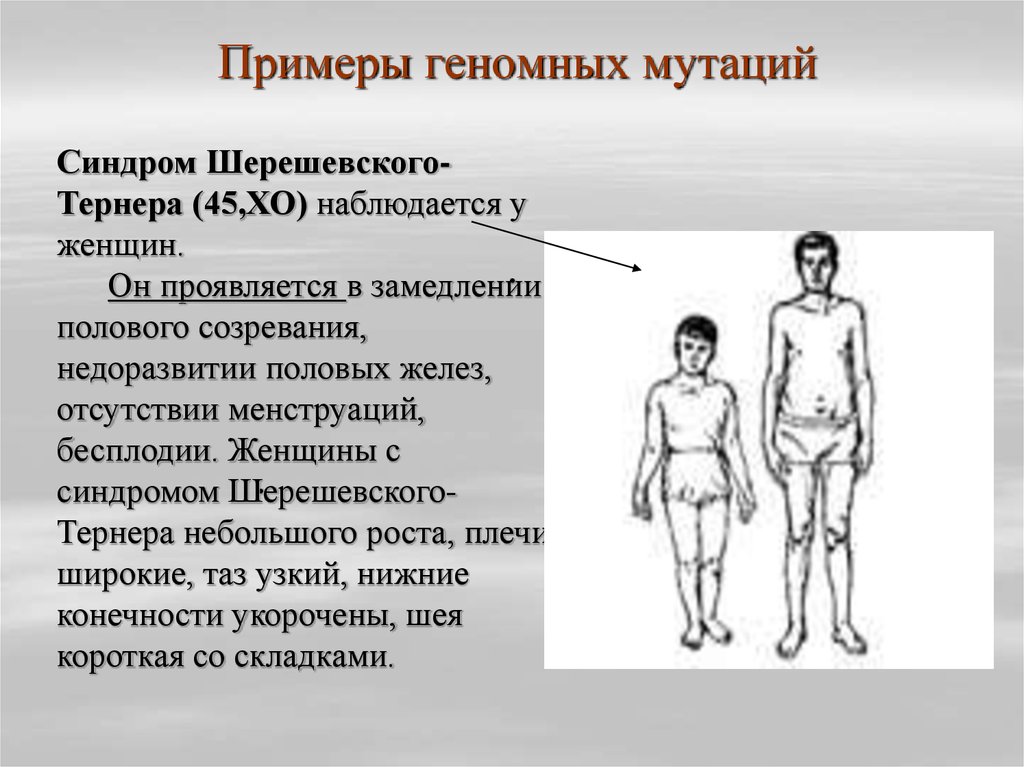 Геномные мутации. Синдром Шерешевского Тернера мутация. Геномные мутации примеры. Примеры геномных мутаций у человека. Синдром Тернера вид мутации.