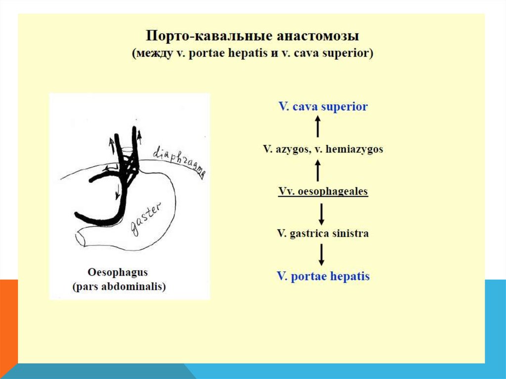 Порто кавальные и кава кавальные анастомозы. Порто-кава-кавальный анастомоз. Порто и кава кавальные анастомозы схема. Кава-кавальный анастомоз схема. УЗИ картина Порто кавальных анастомозов.