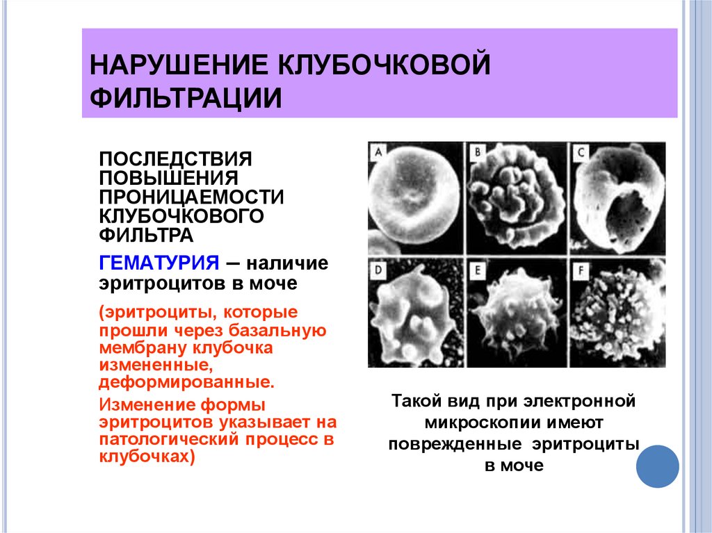 Факторы клубочковой фильтрации