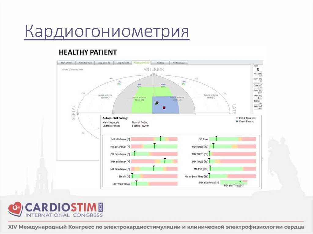 Кардиогониометрия
