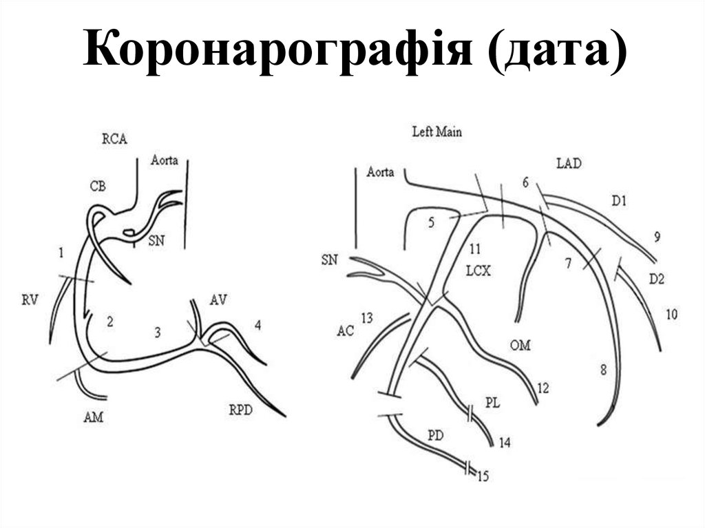 Коронарография сосудов сердца что это. Проекции коронарографии. Коронарография схема.