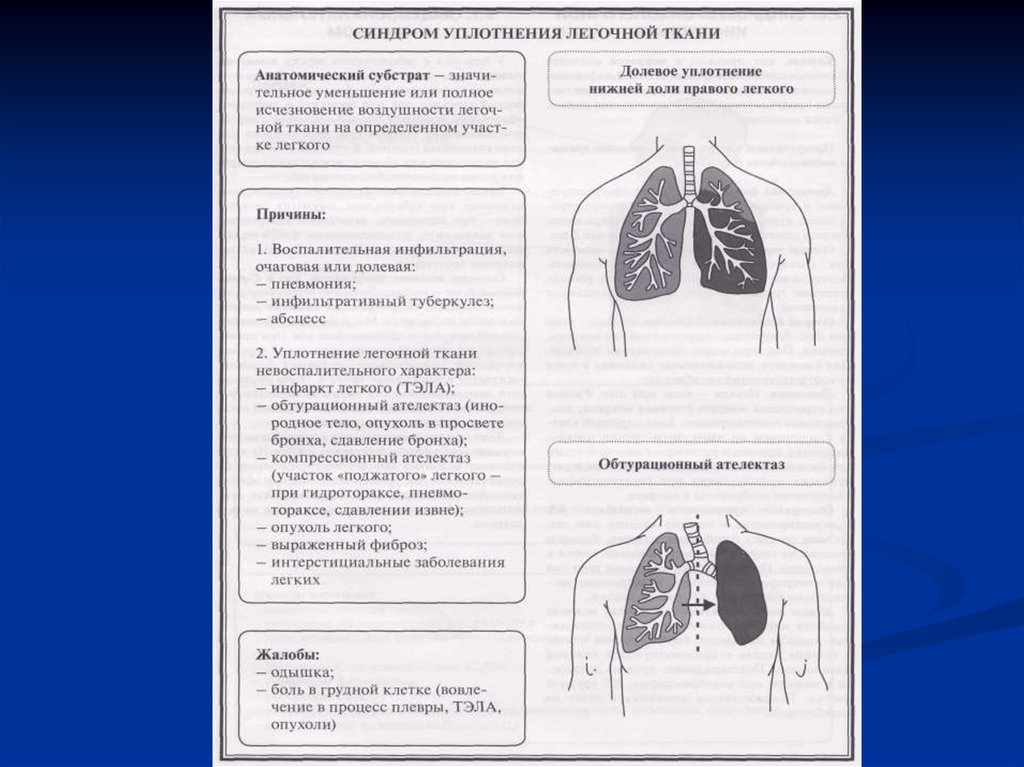 Поражение легочных тканей. Синдромы дыхательной системы пропедевтика. Синдромы органов дыхания пропедевтика. Синдромы при заболеваниях дыхательной системы пропедевтика таблица. Легочные синдромы пропедевтика внутренних болезней.
