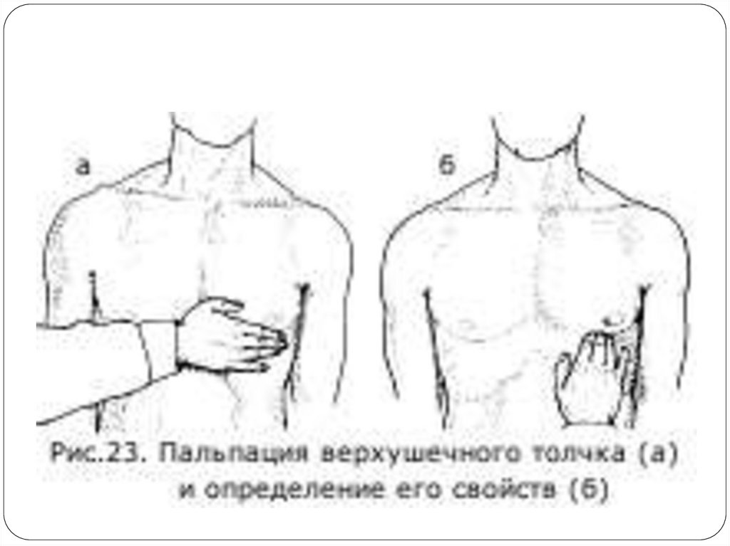 Пальпация сердца. Пальпация сердечного толчка. Пальпация верхушечного толчка сердца алгоритм. Пальпация верхушечного толчка алгоритм. Верхушечный толчок пропедевтика.