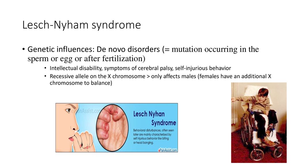 Lesch-Nyham syndrome