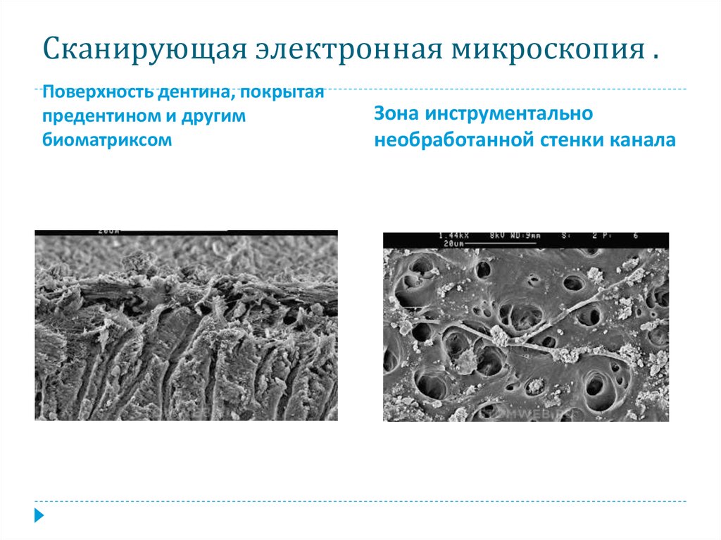 Сканирующая электронная микроскопия