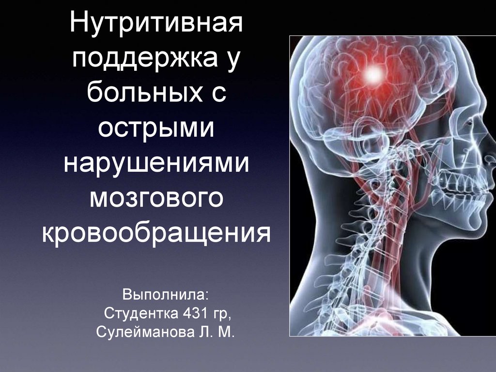 Презентация инсульт для школьников