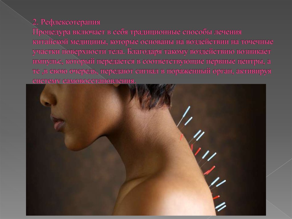2. Рефлексотерапия Процедура включает в себя традиционные способы лечения китайской медицины, которые основаны на воздействии