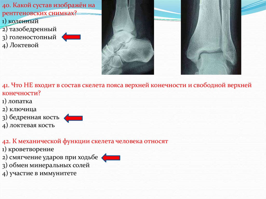 Какой цифрой на рисунке обозначен суставной хрящ